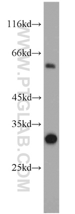 QDPR Antibody in Western Blot (WB)