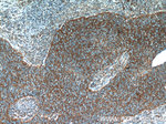 NDUFB7 Antibody in Immunohistochemistry (Paraffin) (IHC (P))