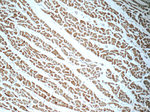 NDUFB7 Antibody in Immunohistochemistry (Paraffin) (IHC (P))