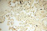 NDUFB7 Antibody in Immunohistochemistry (Paraffin) (IHC (P))