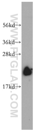 NDUFB7 Antibody in Western Blot (WB)