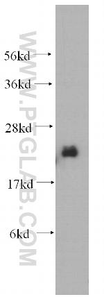 NDUFB7 Antibody in Western Blot (WB)