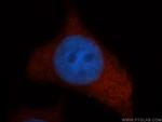 UROS Antibody in Immunocytochemistry (ICC/IF)