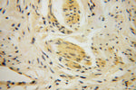 UROS Antibody in Immunohistochemistry (Paraffin) (IHC (P))