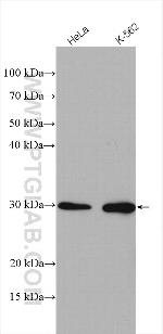 UROS Antibody in Western Blot (WB)