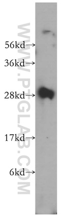 UROS Antibody in Western Blot (WB)