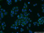 TOB1 Antibody in Immunocytochemistry (ICC/IF)