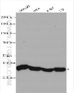 NTHL1 Antibody in Western Blot (WB)