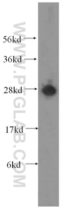 ATP6V1D Antibody in Western Blot (WB)