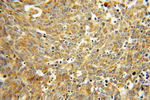 ATP6V1D Antibody in Immunohistochemistry (Paraffin) (IHC (P))