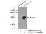 ATP6V1D Antibody in Immunoprecipitation (IP)