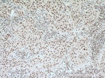 THUMPD1 Antibody in Immunohistochemistry (Paraffin) (IHC (P))