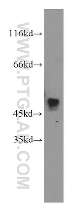 THUMPD1 Antibody in Western Blot (WB)