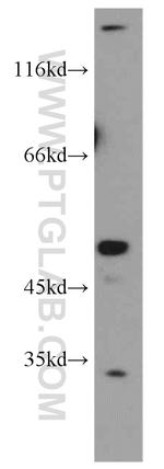 THUMPD1 Antibody in Western Blot (WB)