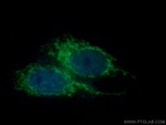 TIM22 Antibody in Immunocytochemistry (ICC/IF)