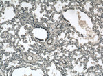 TIM22 Antibody in Immunohistochemistry (Paraffin) (IHC (P))