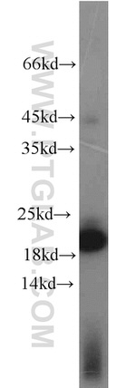 TIM22 Antibody in Western Blot (WB)