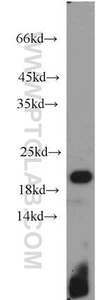 TIM22 Antibody in Western Blot (WB)