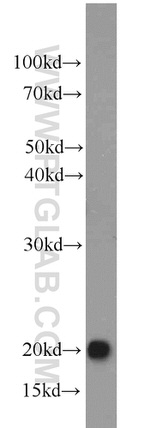 TIM22 Antibody in Western Blot (WB)