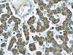 TIM22 Antibody in Immunohistochemistry (Paraffin) (IHC (P))