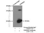 TIM22 Antibody in Immunoprecipitation (IP)