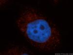 GNPAT Antibody in Immunocytochemistry (ICC/IF)