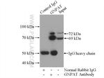 GNPAT Antibody in Immunoprecipitation (IP)