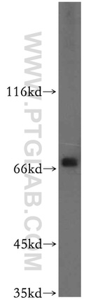 GNPAT Antibody in Western Blot (WB)