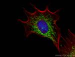 MECR Antibody in Immunocytochemistry (ICC/IF)