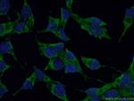 MECR Antibody in Immunocytochemistry (ICC/IF)