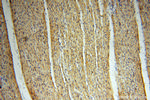 MECR Antibody in Immunohistochemistry (Paraffin) (IHC (P))