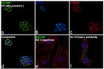 CD326 (EpCAM) Antibody