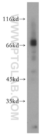 URAT1 Antibody in Western Blot (WB)