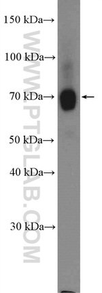 URAT1 Antibody in Western Blot (WB)