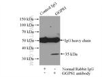 GGPS1 Antibody in Immunoprecipitation (IP)