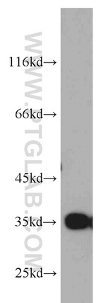 GGPS1 Antibody in Western Blot (WB)