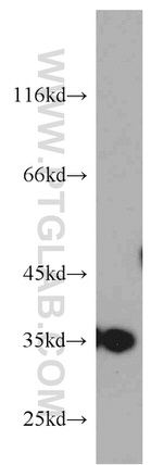 GGPS1 Antibody in Western Blot (WB)