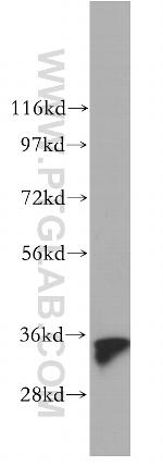 GGPS1 Antibody in Western Blot (WB)