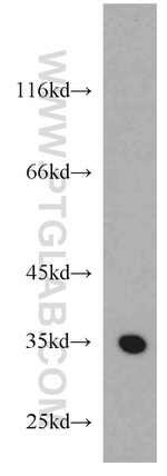 GGPS1 Antibody in Western Blot (WB)