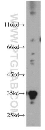 GGPS1 Antibody in Western Blot (WB)