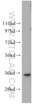 GGPS1 Antibody in Western Blot (WB)