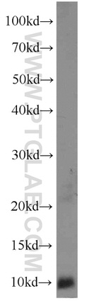 RPS27A Antibody in Western Blot (WB)