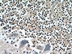 RPS27A Antibody in Immunohistochemistry (Paraffin) (IHC (P))