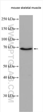 LMOD3 Antibody in Western Blot (WB)