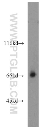 LMOD3 Antibody in Western Blot (WB)