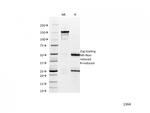 Catenin, alpha-1 (CTNNA1) Antibody in SDS-PAGE (SDS-PAGE)