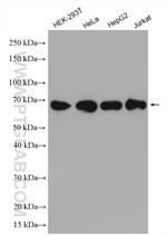 KARS Antibody in Western Blot (WB)