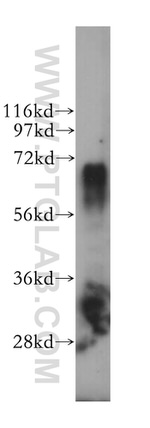 KARS Antibody in Western Blot (WB)