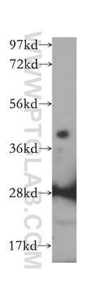 IGBP1 Antibody in Western Blot (WB)