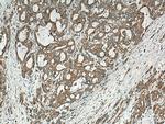 BEGAIN Antibody in Immunohistochemistry (Paraffin) (IHC (P))